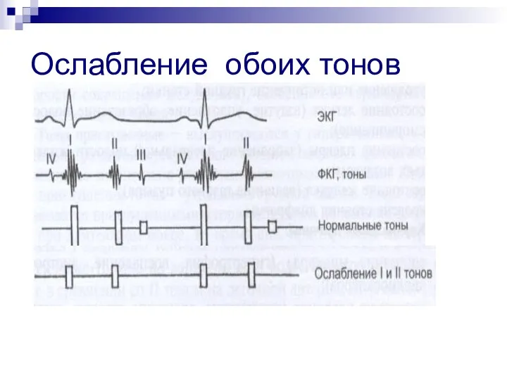 Ослабление обоих тонов