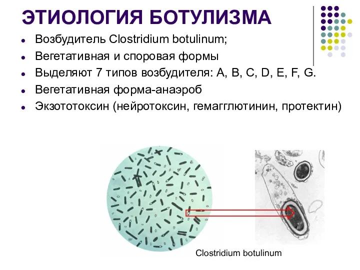 ЭТИОЛОГИЯ БОТУЛИЗМА Возбудитель Clostridium botulinum; Вегетативная и споровая формы Выделяют 7 типов возбудителя: