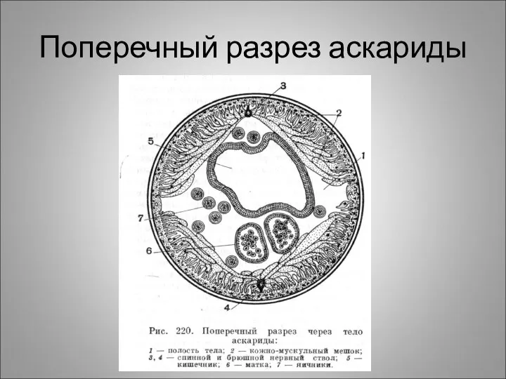 Поперечный разрез аскариды