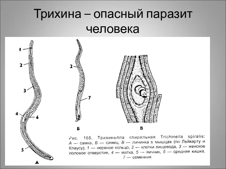 Трихина – опасный паразит человека