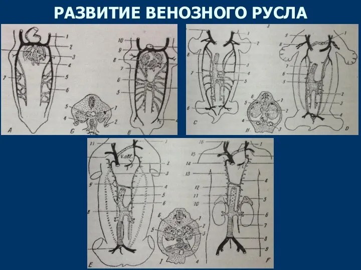 РАЗВИТИЕ ВЕНОЗНОГО РУСЛА