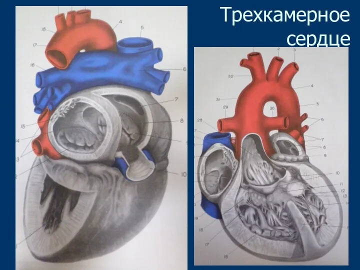 Трехкамерное сердце