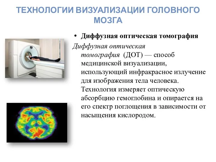 ТЕХНОЛОГИИ ВИЗУАЛИЗАЦИИ ГОЛОВНОГО МОЗГА Диффузная оптическая томография Диффузная оптическая томография