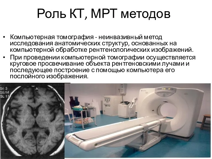 Роль КТ, МРТ методов Компьютерная томография - неинвазивный метод исследования