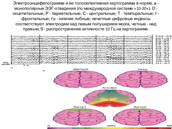 Электроэнцефалограмма и ее топоселективная картограмма в норме. а - монополярные