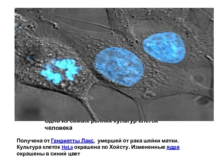 Одна из самых ранних культур клеток человека Получена от Генриетты