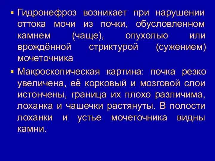 Гидронефроз возникает при нарушении оттока мочи из почки, обусловленном камнем