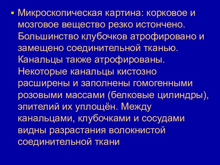 Микроскопическая картина: корковое и мозговое вещество резко истончено. Большинство клубочков