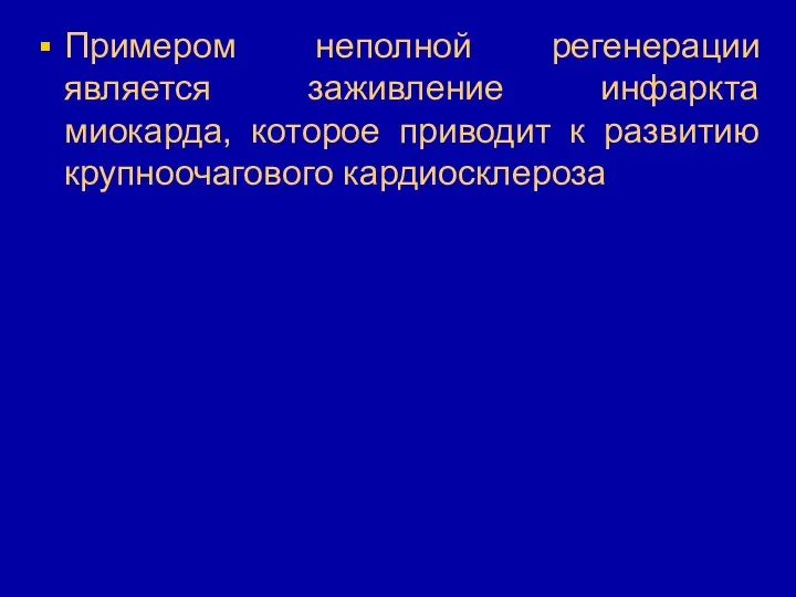 Примером неполной регенерации является заживление инфаркта миокарда, которое приводит к развитию крупноочагового кардиосклероза