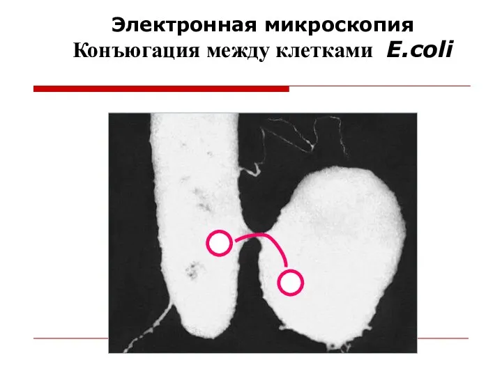 Электронная микроскопия Конъюгация между клетками E.coli