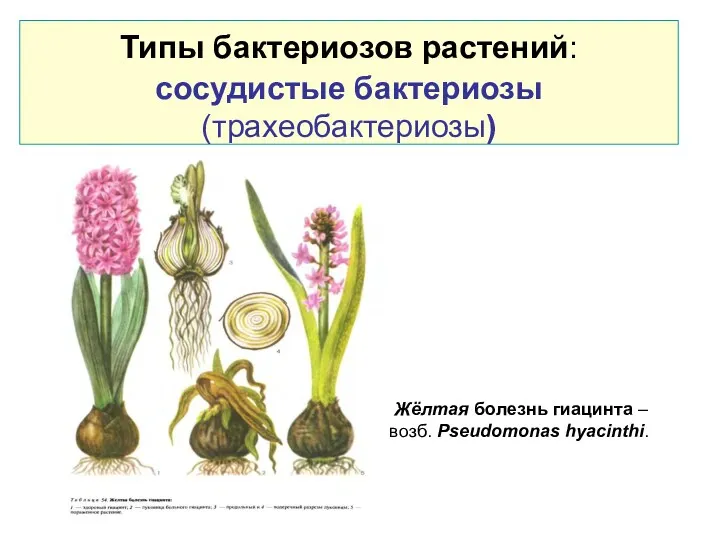 Типы бактериозов растений: сосудистые бактериозы (трахеобактериозы) Жёлтая болезнь гиацинта – возб. Pseudomonas hyacinthi.