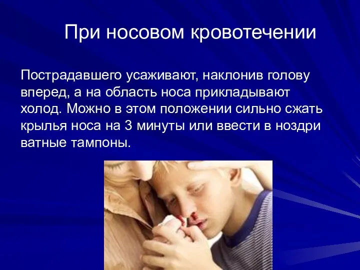 При носовом кровотечении Пострадавшего усаживают, наклонив голову вперед, а на