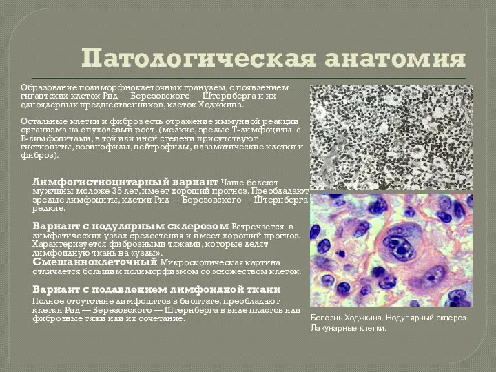 Патологическая анатомия Образование полиморфноклеточных гранулём, с появлением гигантских клеток Рид — Березовского —