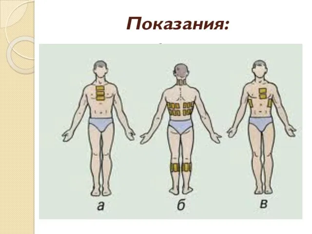 Показания: воспалительные заболевания органов дыхания – на грудную клетку, исключив позвоночник, молочные железы;