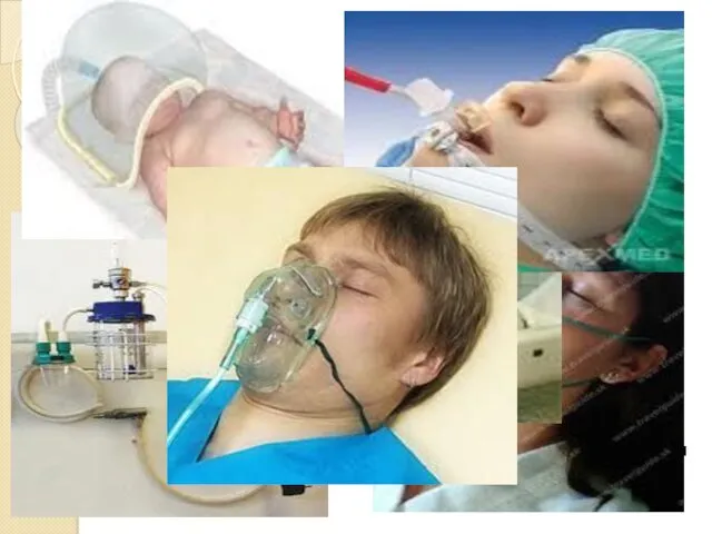 Виды оксигенотерапии: Ингалляционная – через дыхательные пути: при помощи кислородной маски; через носовой