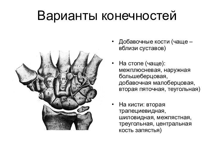 Варианты конечностей Добавочные кости (чаще – вблизи суставов) На стопе