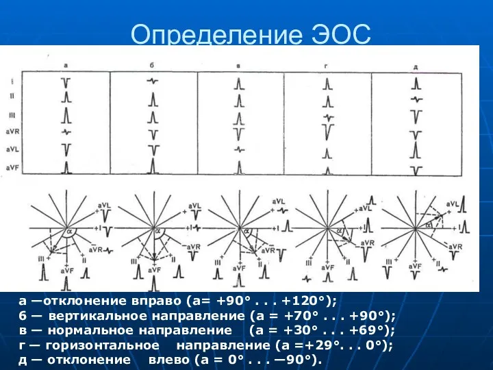 Определение ЭОС а —отклонение вправо (а= +90° . . .