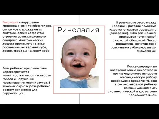 Ринолалия Ринолалия – нарушение произношения и тембра голоса, связанное с