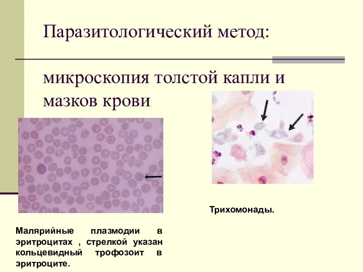 Паразитологический метод: микроскопия толстой капли и мазков крови Малярийные плазмодии в эритроцитах ,