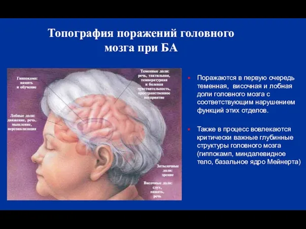 Топография поражений головного мозга при БА Поражаются в первую очередь
