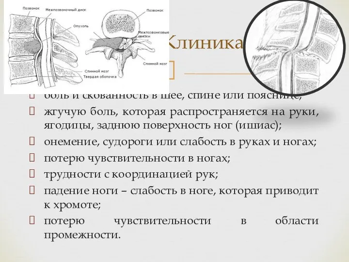 боль и скованность в шее, спине или пояснице; жгучую боль,