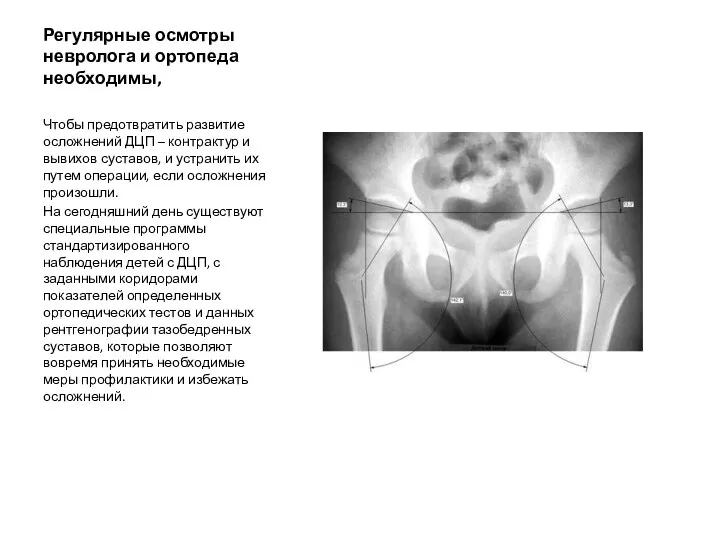 Регулярные осмотры невролога и ортопеда необходимы, Чтобы предотвратить развитие осложнений