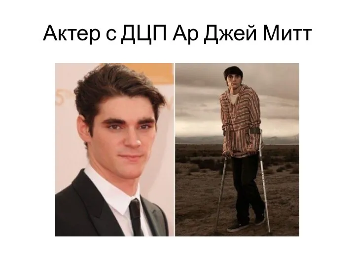 Актер с ДЦП Ар Джей Митт