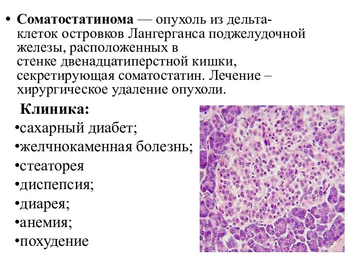 Соматостатинома — опухоль из дельта-клеток островков Лангерганса поджелудочной железы, расположенных
