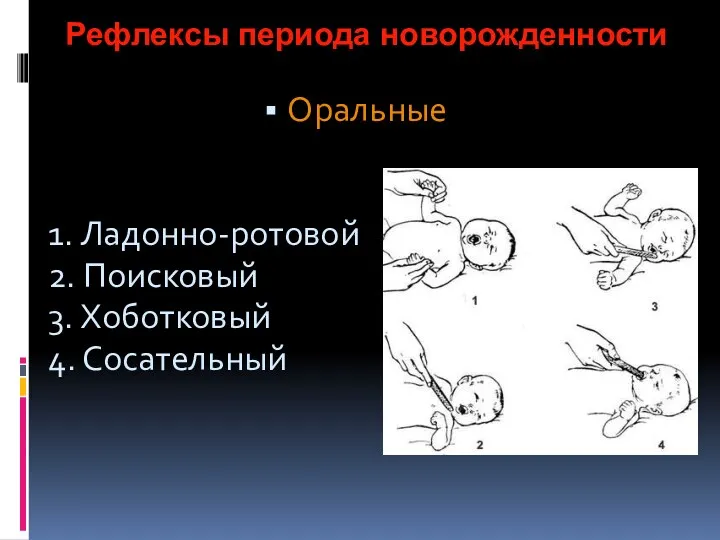 Рефлексы периода новорожденности Оральные 1. Ладонно-ротовой 2. Поисковый 3. Хоботковый 4. Сосательный