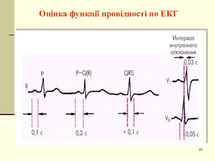 Оцінка функції провідності по ЕКГ