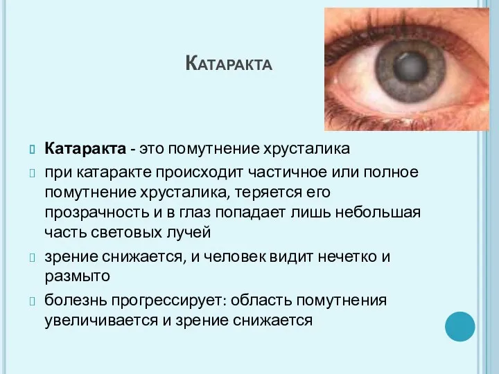 Катаракта Катаракта - это помутнение хрусталика при катаракте происходит частичное