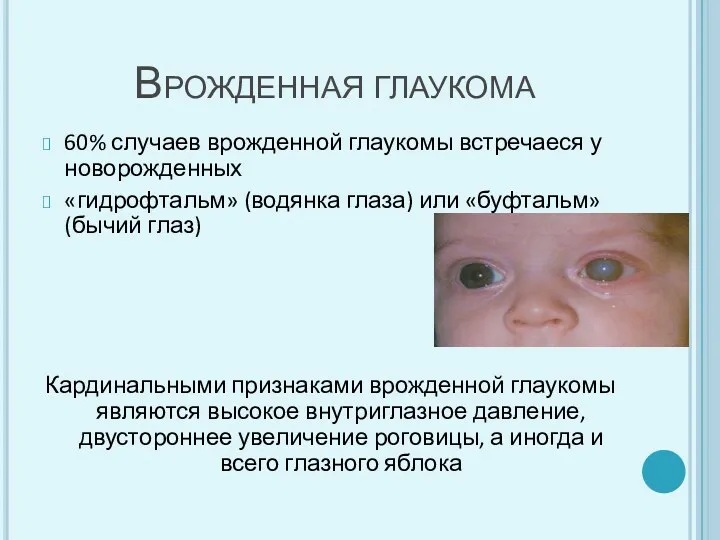 60% случаев врожденной глаукомы встречаеся у новорожденных «гидрофтальм» (водянка глаза)