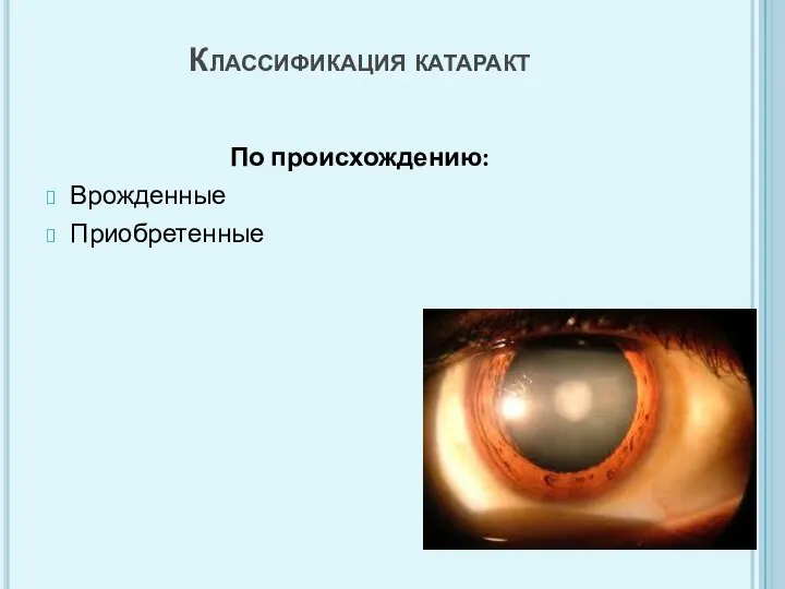 Классификация катаракт По происхождению: Врожденные Приобретенные