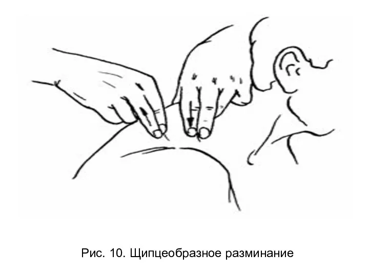 Рис. 10. Щипцеобразное разминание