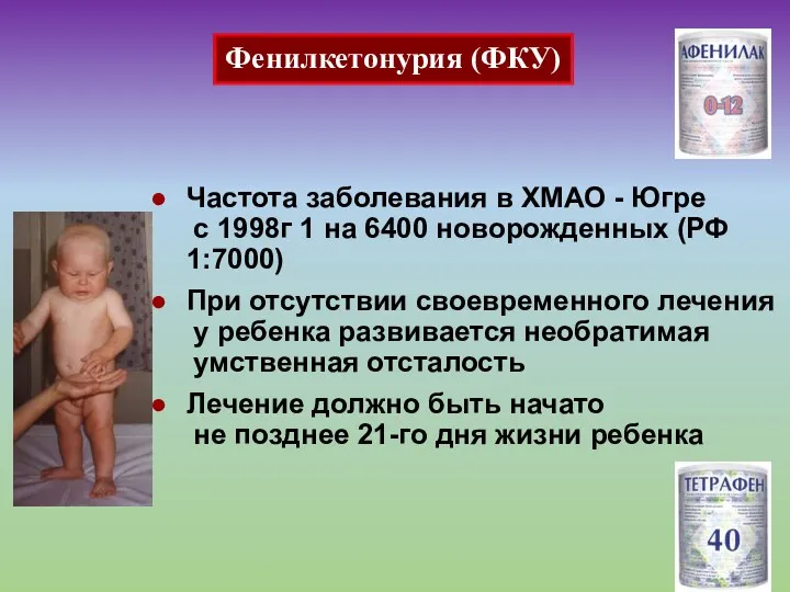 Частота заболевания в ХМАО - Югре с 1998г 1 на 6400 новорожденных (РФ