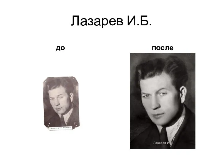Лазарев И.Б. до после