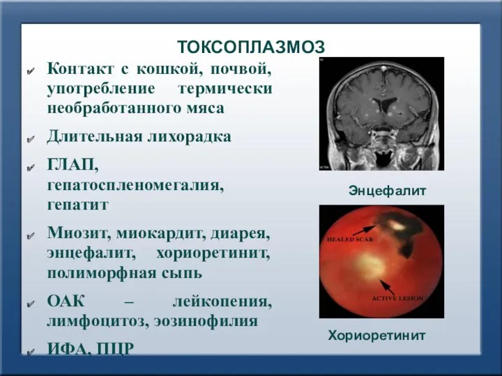 ТОКСОПЛАЗМОЗ Контакт с кошкой, почвой, употребление термически необработанного мяса Длительная