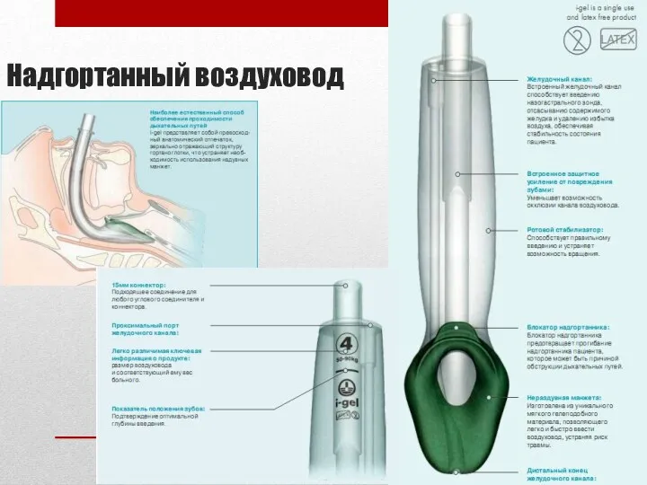 Надгортанный воздуховод