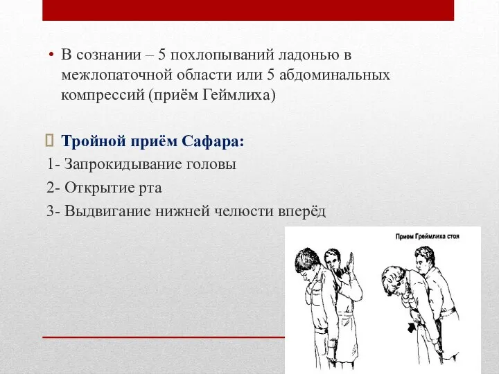 В сознании – 5 похлопываний ладонью в межлопаточной области или