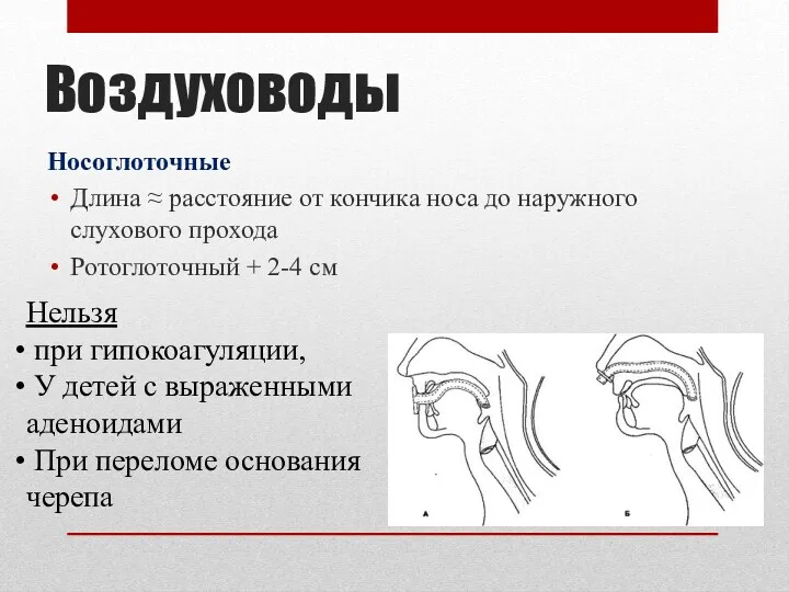 Воздуховоды Носоглоточные Длина ≈ расстояние от кончика носа до наружного