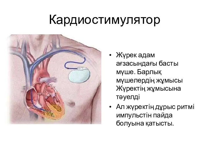 Кардиостимулятор Кардиостимулятордың адам денесінле орналасуы. Жүрек адам ағзасындағы басты мүше.