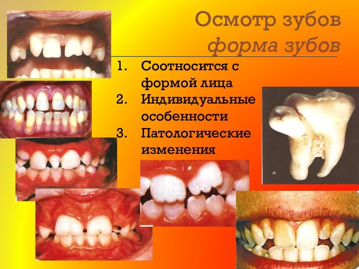 Осмотр зубов форма зубов Соотносится с формой лица Индивидуальные особенности Патологические изменения