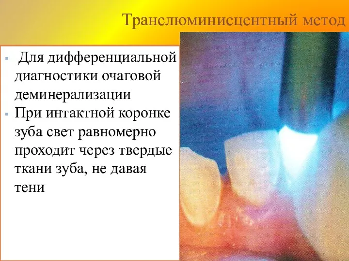 Транслюминисцентный метод Для дифференциальной диагностики очаговой деминерализации При интактной коронке