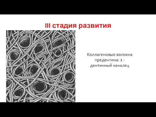 III стадия развития Коллагеновые волокна предентина: 1 - дентинный каналец