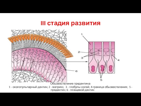 III стадия развития Обызвествление предентина: 1 - околопульпарный дентин; 2