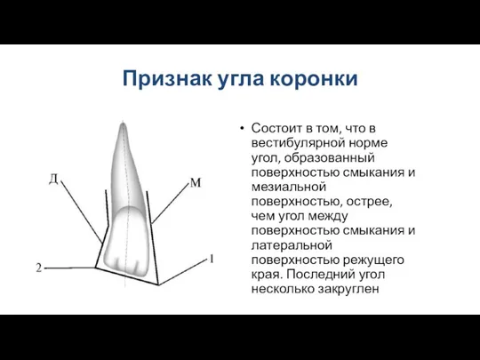 Признак угла коронки Состоит в том, что в вестибулярной норме