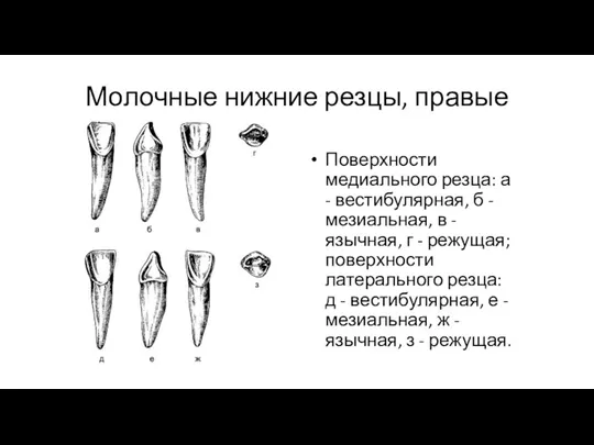 Молочные нижние резцы, правые Поверхности медиального резца: а - вестибулярная,