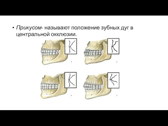 Прикусом- называют положение зубных дуг в центральной окклюзии.