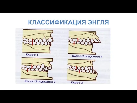 КЛАССИФИКАЦИЯ ЭНГЛЯ