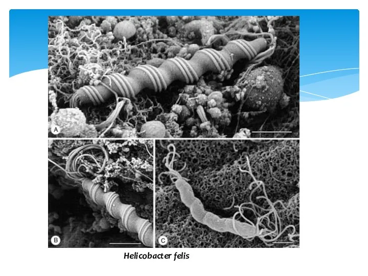 Helicobacter felis